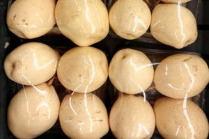 慢性咳嗽的發(fā)病特點及常用檢查方法