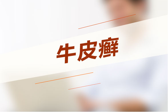 牛皮癬難根治？試試這些土方法！
