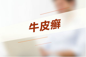 如何診斷牛皮癬？記住這3大臨床特點(diǎn)！
