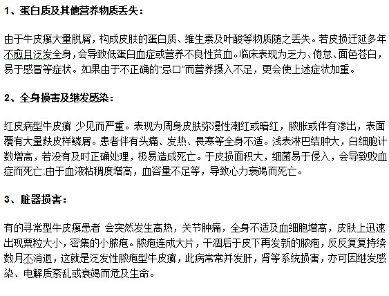 莫要忽視牛皮癬疾病，以下幾種危害你了解嗎？