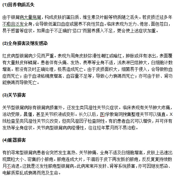不要忽視牛皮癬！嚴重時可引發(fā)多種并發(fā)癥！