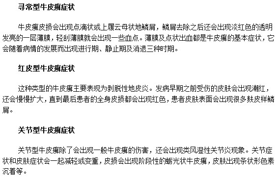 教你識(shí)別三種不同牛皮癬疾病的典型癥狀