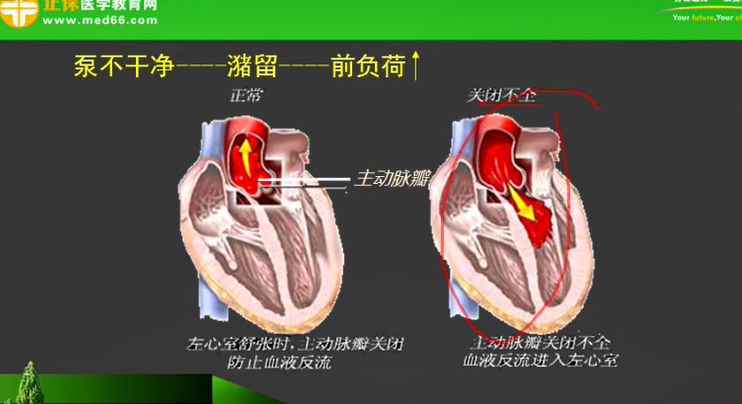 心臟的前負(fù)荷和后負(fù)荷