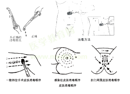 手術(shù)區(qū)消毒