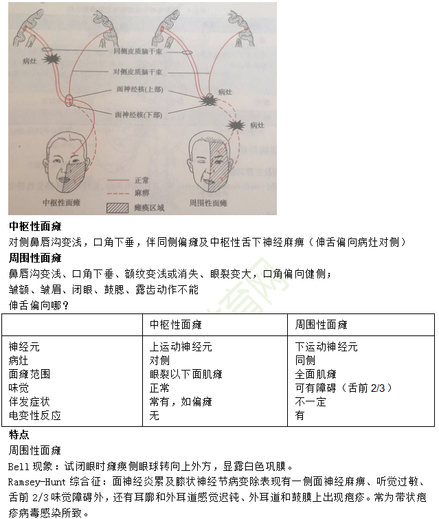 中樞性面癱與周?chē)悦姘c