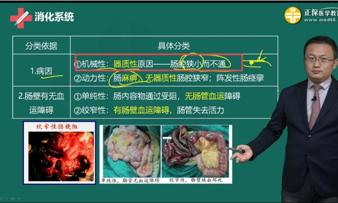 急性腸梗阻