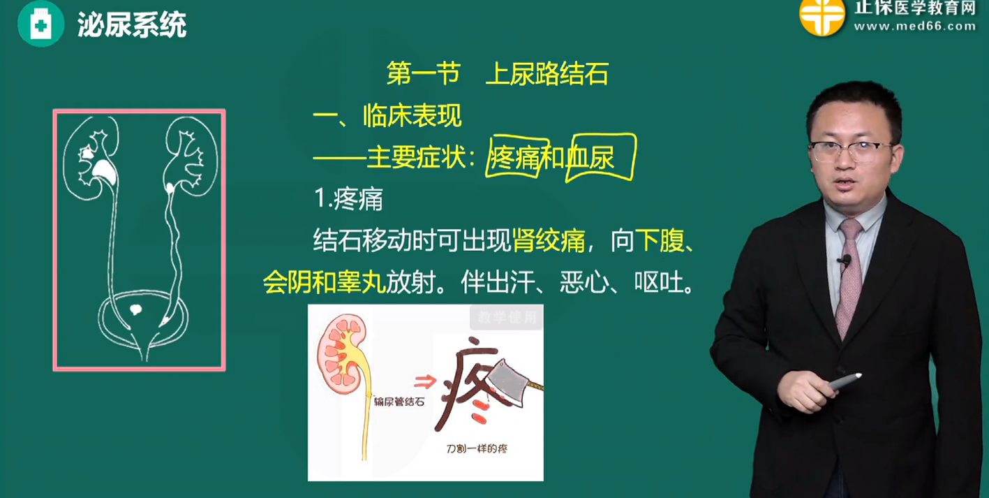 輸尿管結(jié)石典型癥狀是什么